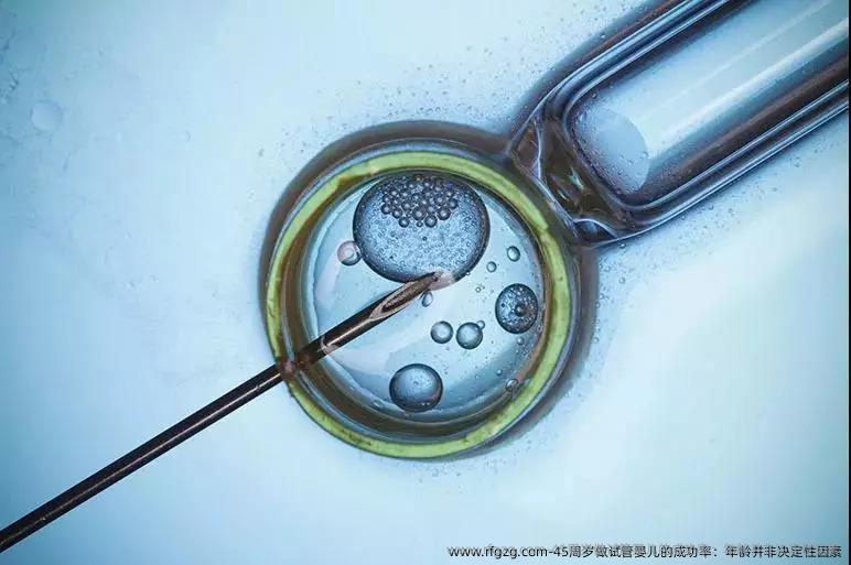45周岁做代孕的成功率：年龄并非决定性因素