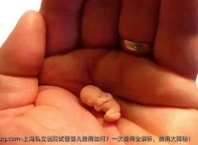 上海私立医院代孕费用如何？一次费用全解析，费用大揭秘！