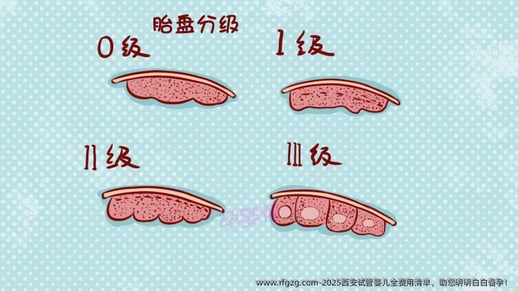 2025西安代孕全费用清单，助您明明白白备孕！