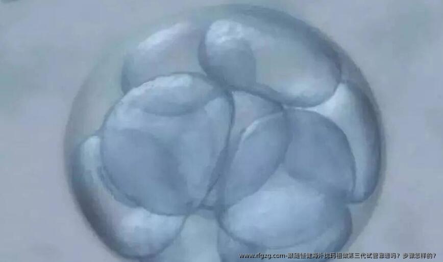 跟随**海外找玛祖做第三代试管靠谱吗？步骤怎样的？