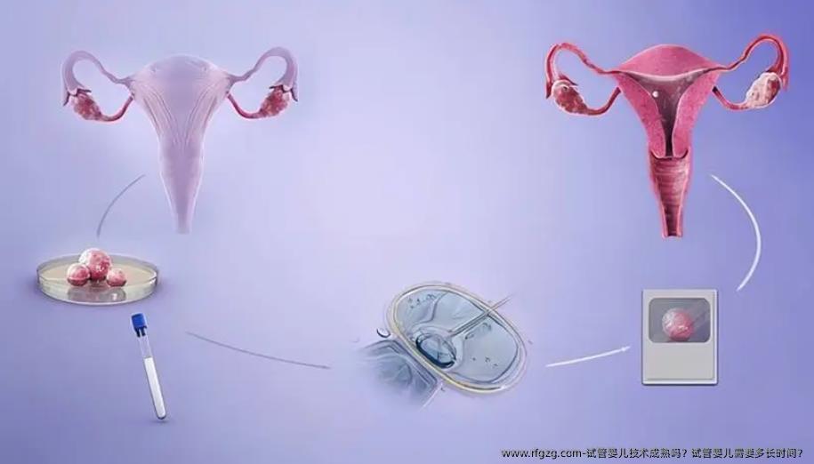 代孕技术成熟吗？代孕需要多长时间？