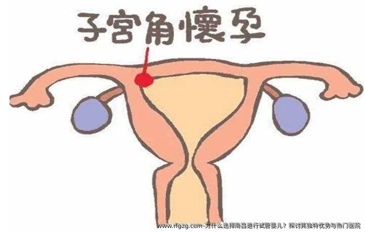 为什么选择南昌进行代孕？探讨其独特优势与热门医院