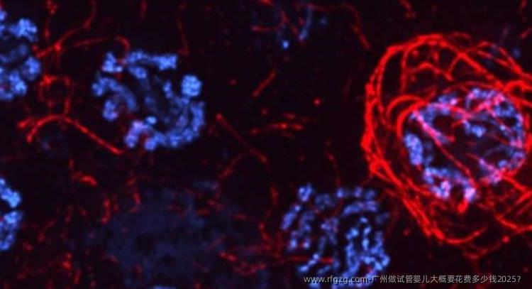 广州做试管婴儿大概要花费多少钱2025？