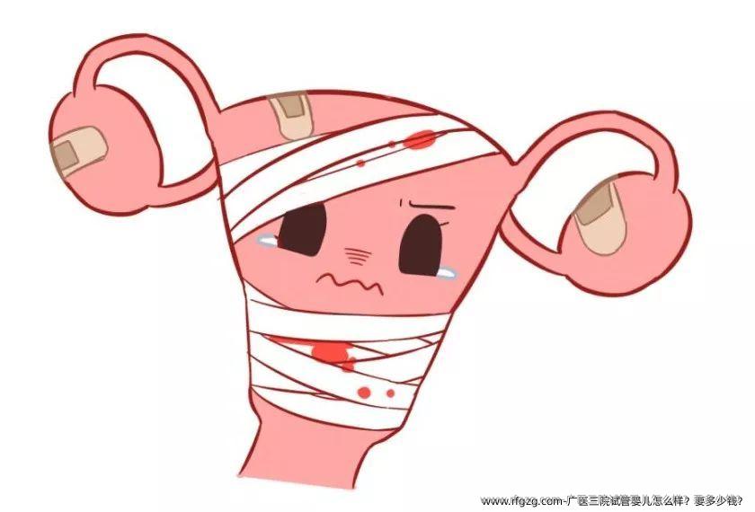 广医三院代孕怎么样？要多少钱？
