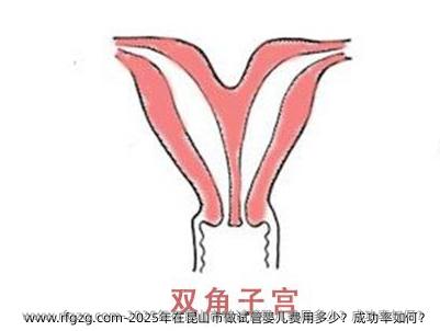 2025年在昆山市做代孕费用多少？成功率如何？